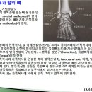 [11강-발목/발-29](108강) 발목과 발의 뼈 촉진(1),내과,외과,발목관절,거골,발목뼈굴등 이미지