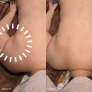 장림동원 로얄듀크아파트 | 사하구 등관리 제대로 받았던 장림 퀸스킨케어 수기관리 후기