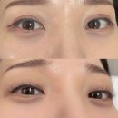 엘한방병원 | 요즘 핫한 엘이디펌포인트 연장으로 자연스럽게 예뻐지기 부천시청 속눈썹 연장 [젠브로우] 후기