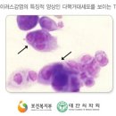 안명반점 | 바이러스 총론/ 각론