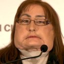 First U.S. face transplant recipient offers thanks 이미지