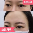 소미 | [송도눈썹] 소미지우에서 자연눈썹 케어 후기