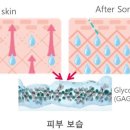 소노케어 이미지