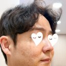 비비드짐 | 검단 김포 기미 미백 피부관리샵 방문 후기 비비드엘