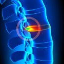 씨티한방병원 이미지