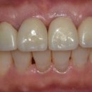 웰치과기공소 이미지