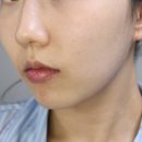 속기미 앰플 한달 사용 후기 엑소머 셀리노바 흔적앰플 꾸준히 써본 솔직 리뷰