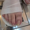 네일라이프 | 광주 내성발톱 2회만에 달라진 날 | 뷰티업라이프 페디네일 광주본점 진짜후기