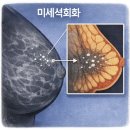유사 의료업 | [1] 30대 초반 유방암 수술 후기와 유방암 관련 중요 정보
