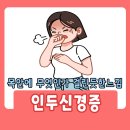 법인두가시
