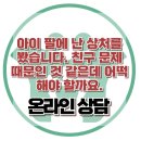 [온라인 상담 : 아이 팔에 난 상처를 봤습니다. 친구 문제 때문인 것 같은데 어떡해야 할까요.] 한국아동청소년심리상담센터 이미지