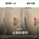 슬림 | 송도 엔더몰로지 스파아루카 여름 한정 할인 이벤트 상체 슬림관리 솔직 후기