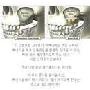 임상8기 박효정 구강 악 안면 외과 예습 이미지