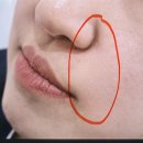 서울베스트외과의원 | [노원 피부과] "더베스트의원" 방문 쥬베룩 볼륨 후기