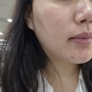 꽃 - 화해 | 화해 어워드 1등 피부과 시술 후 바르는 EGF 유기자차 선크림 뉴베리프 백합 리커버리 솔직후기