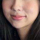 뷰티하이 | [뷰티 디바이스] 메디큐브 하이포커스샷 플러스 내돈내산 한달 후기