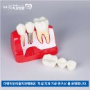 우리들치과기공소 네이버블로그