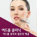 리스 에스테틱 네이버블로그