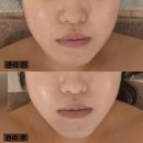 마곡역 윤곽관리 유앤제이 에스테틱 1회만으로 효과 본 마곡역 피부관리 후기