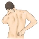 척추 골수염[Vertebral osteomyelitis]근골격질환 이미지