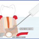 홈플란트치과의원 이미지