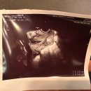 하단동211 | 부산 하단 미래아이병원 산부인과 8과 최경아 원장님 17주차 진료 후기(타병원 맥수술 후 피비침)