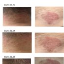 둥지한의원 이미지