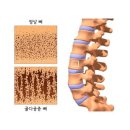 다공 이미지