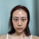 유니풀의원 이미지