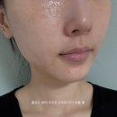 아이모드 | 홈모드 써마 리프트 내돈내산 5주 사용 후기 (아이모드, 페이스업 모드)