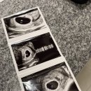 식사위여성의원 | 콩알이 어느새 7주차 진입! + 심장소리 듣고왔어요 (행신 연세맘스그린여성의원)