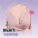 바노바기성형외과의원 네이버블로그