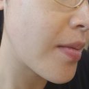 아로美피부관리실 | 김해 아로마진에스테틱 윤곽관리로 하루동안 피부가 빛나던 날!