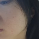 스킨오가닉 | ✨연산동 클린스킨 두피 탈모케어 후기｜부산 피부관리 &amp; 오가닉 에스테틱✨ #연산동 #클린스킨 #두피...