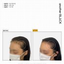 아인뷰티의원 이미지