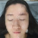 유고왁싱(ugo waxing) | [유고왁싱] 대구 왁싱 ∥ 헤어라인 왁싱, 구렛나루 왁싱 후기