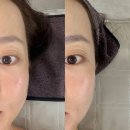 파주 운정피부관리 손길에스테틱 물방울리프팅 솔직 후기