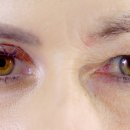 스누성형외과의원 이미지