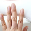 아코네일 이미지