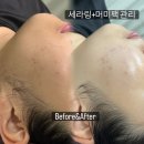세라믹덴탈솔루션 | 결혼식 전 메이크업 뜨지않으려면? 세라링