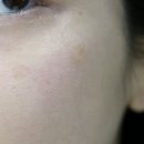 태극약국 | 얼굴 기미 검버섯 제거 태극제약 도미나 크림 연고 약국 가격 효과 바르는 법 내돈내산 후기