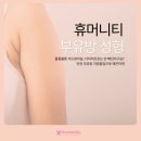 휴머니티성형외과의원 | 다이어트로 절대 안빠지는 겨드랑이살,인천 부유방 지방흡입 수술 휴머니티성형외과
