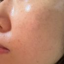 더미스 | 루아에스틱 더미스 리페어 필, 약초침 필링, 피부재생관리 노폐물 각질관리