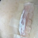 네일클리닉 - 평택시 고덕국제3길 136 | 양산속눈썹펌 조아랑네일에서 클리닉 블랙틴팅 수분 속눈썹펌 받고 온 후기