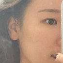 천안청당초등학교 | 천안 피부관리 속건조 잡고 온 뉴에스테틱 후기