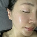 심해진 | 건조한 사무실 얼굴 홍조 심해진 이유와 해결 후기