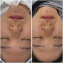 유포리아 에스테틱 | [청량리 에스테틱] 유포리아 - 스파쿨링 모공샤워 모공관리 후기
