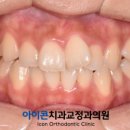 아이콘치과교정과의원 네이버블로그