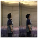 송윤숙상생약발 | 부천 소사 중동 마사지샵 &#39;송윤숙 상생약발&#39; 어깨 관리후기(전,후사진포함)