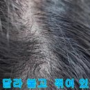 꺾인모발 복구매직 시술 후기 이미지